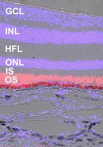 Cropped 2013039L-82F-monoclonalAb-1D4-DIC-RB-20x